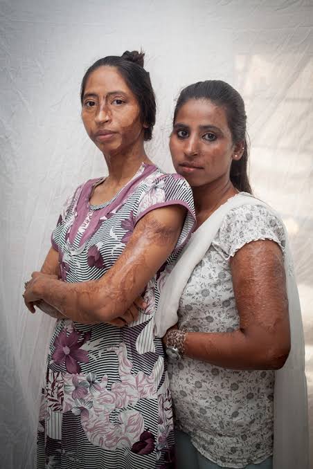 Reconstructive care coordination for acid attack survivors