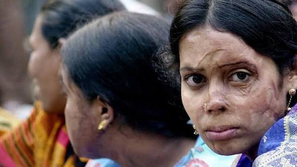 Confidence workshop for acid attack survivors