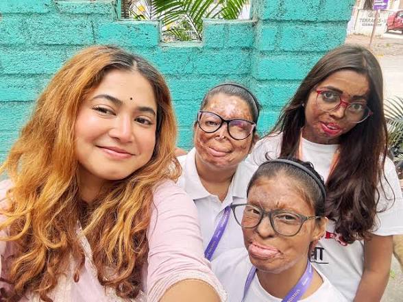 Education support for acid attack survivors